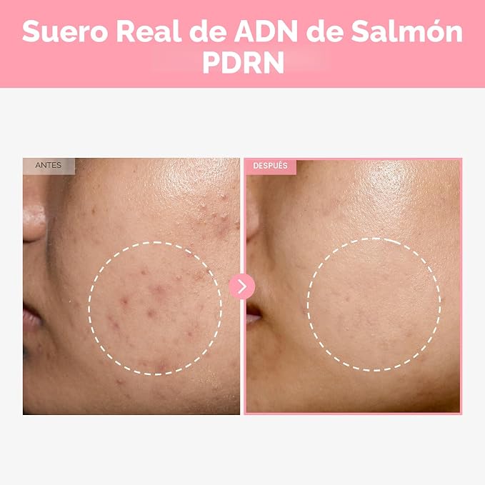 TOSOWOONG | Pink Peptide 12 PDRN Serum 33ml | PDRN de Salmón + 12 Péptidos