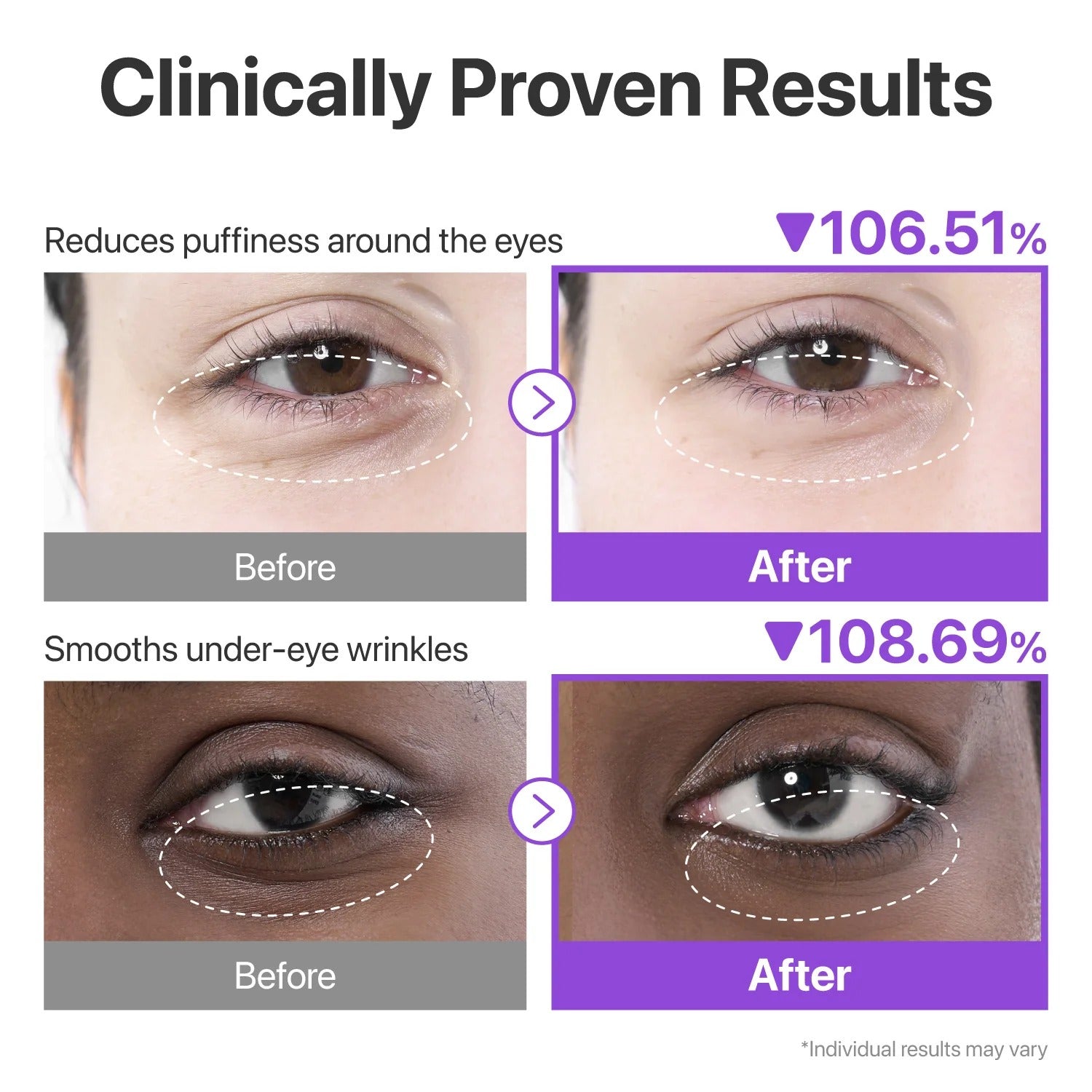NUMBUZIN | No.9 NAD+ Collagen Under Eye Patches (1 Par)